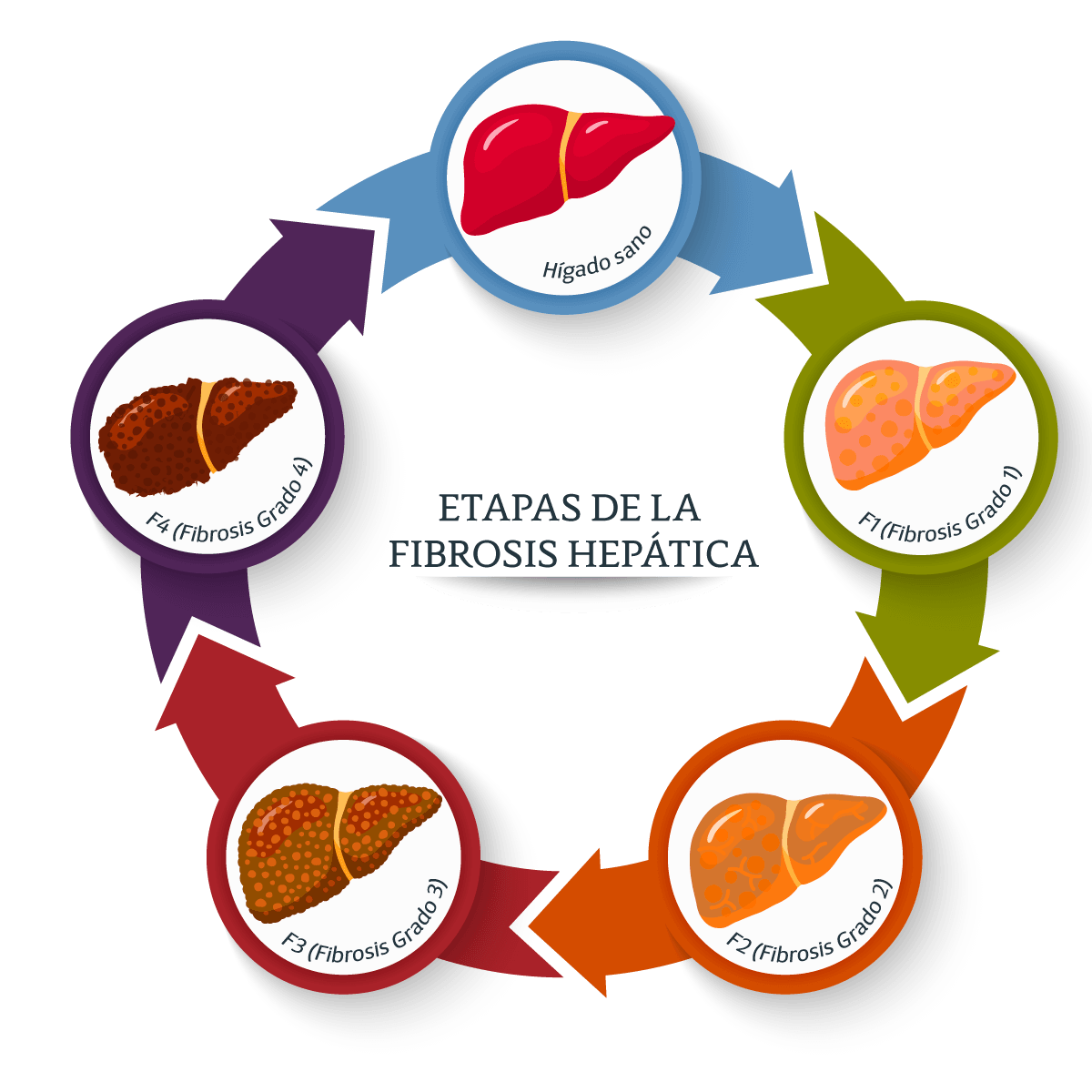 Guía de interpretación de fibrosis hepática
